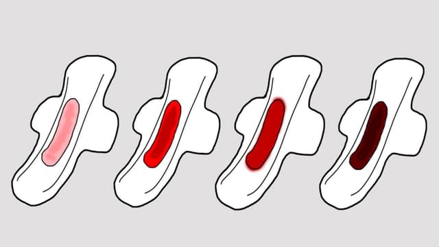 Tại sao phụ nữ lại bị hiện tượng rong kinh ra máu đen?