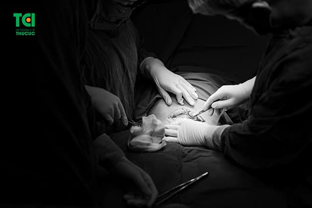 Thông thường, mẹ bầu sinh mổ sẽ được chỉ định mổ chủ động hoặc mổ cấp cứu tùy theo tình trạng, diễn biến sức khỏe của thai phụ, thai nhi