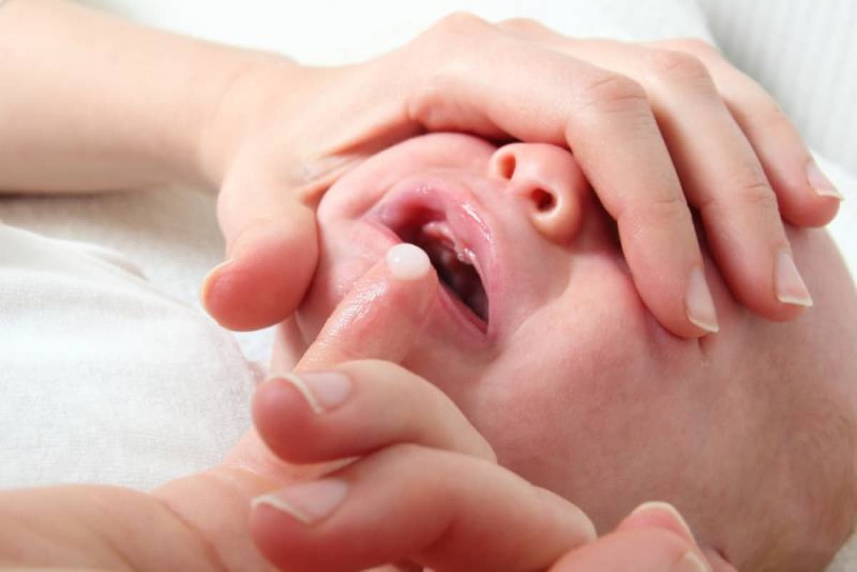 Giải đáp: Nấm miệng ở trẻ em có nguy hiểm không