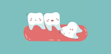 Răng 8 mọc ngầm: Dấu hiệu nhận biết và cách xử lý