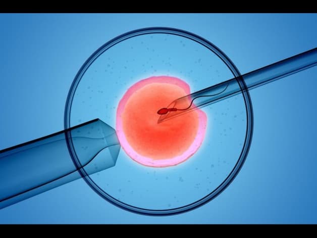 Rối loạn kinh nguyệt sau IVF do thuốc hormone