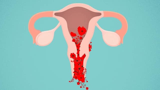 Sau khi sinh mổ bị rong kinh có nguy hiểm không?