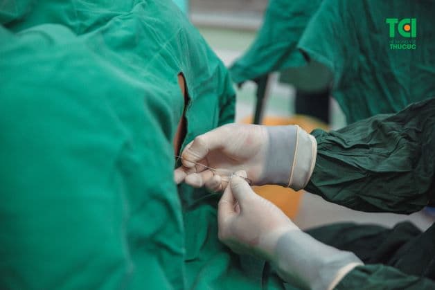 Ảnh hưởng từ quá trình gây tê tủy sống có thể là nguyên nhân gây nên tình trạng tắc tia sữa sau sinh mổ