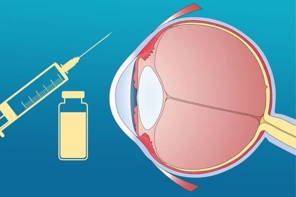 Có thể làm chậm diễn biến của bệnh bằng việc sử dụng thuốc, laser hoặc quang động học