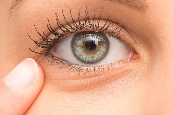 Triệu chứng thiên đầu thống thường gặp là căng tức, đau nhức mắt dữ dội