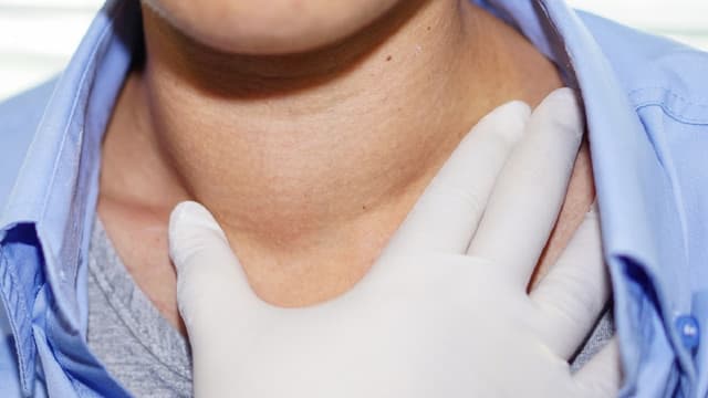 Từ A – Z về khám sàng lọc ung thư vòm họng