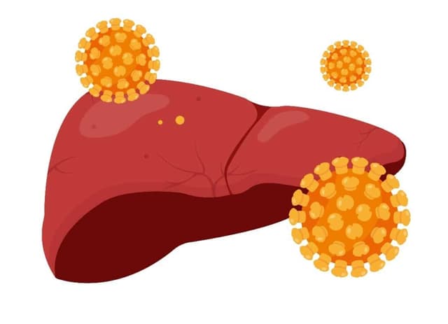 (Dantri) Nguy cơ ung thư gan ở nhóm người nhiễm HIV vì virus viêm gan C