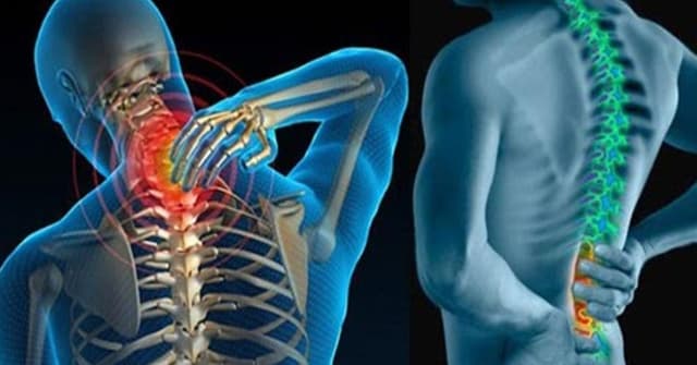 Điều trị vôi hóa cột sống và những điều cần lưu ý