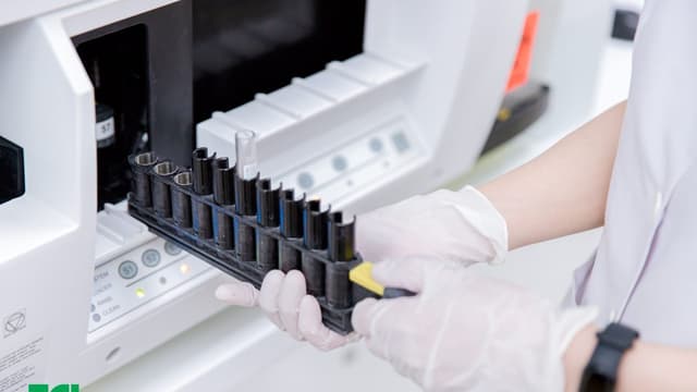 Làm gì khi chỉ số xét nghiệm dấu ấn tầm soát ung thư phổi cao