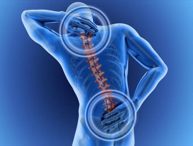 Vôi hóa cột sống gặp nhiều nhất là ở lưng và cổ