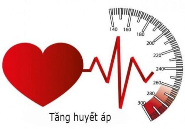 Tăng huyết áp là nguyên nhân khởi phát bệnh thoái hóa võng mạc