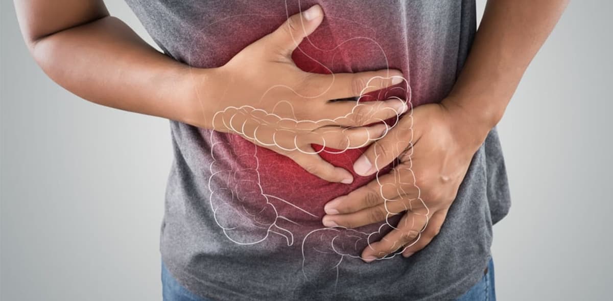 Biểu hiện đau đại tràng là gì? Đau đại tràng là đau ở đâu?