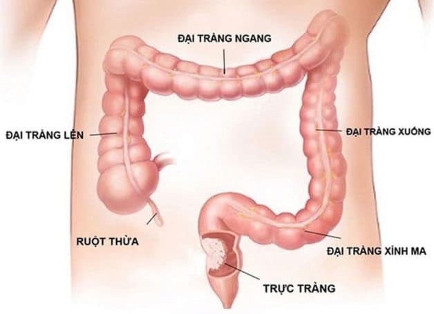 Vị trí, cấu tạo đại tràng (ruột già)