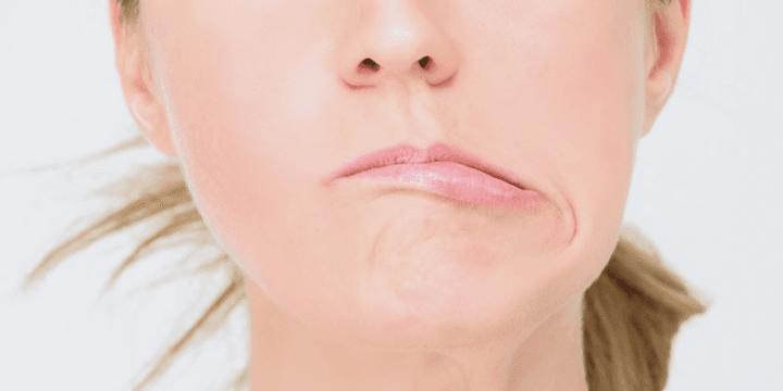 Liệt mặt, méo miệng là một trong các dấu hiệu của đột quỵ não