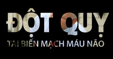 Các dấu hiệu của đột quỵ não mà bạn cần biết