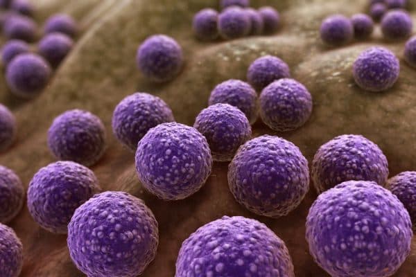 Staphylococcus là một trong những nguyên nhân hàng đầu dẫn tới viêm bờ mi
