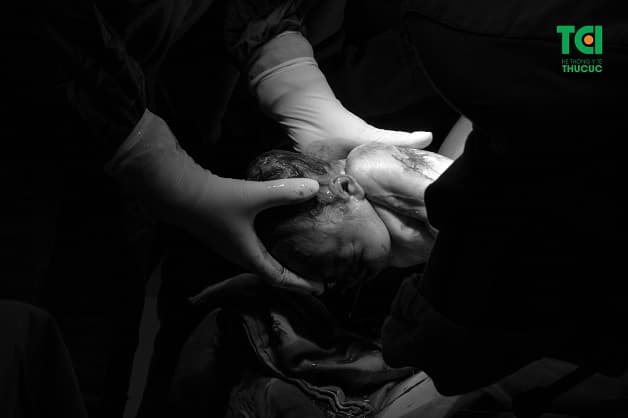 Đẻ thường là phương pháp sinh nở thuận tự nhiên thông qua đường ống sinh sản của mẹ