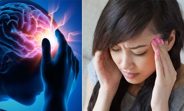 Đau đầu là biểu hiện điển hình của đột quỵ