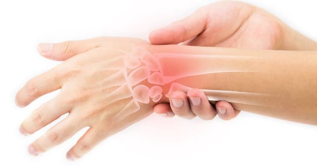 Hội chứng ống cổ tay và biểu hiện tê cổ tay, bàn tay cần nhận biết