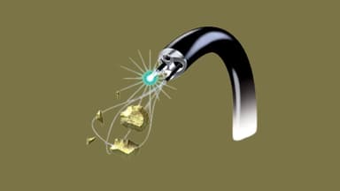 Hướng dẫn cách điều trị sỏi đường tiết niệu