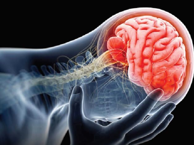 Nguyên nhân gây sa sút trí tuệ thể Lewy