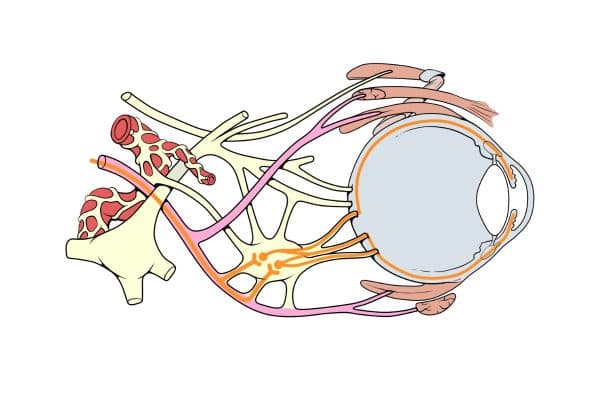 Liệt dây thần kinh mắt số 3 do hội chứng đỉnh hố mắt, khe giơi, xoang hang hay chấn thương có thể là nguyên nhân gây sụp mí mắt