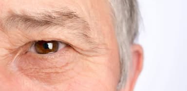 Tìm hiểu các nguyên nhân gây sụp mí mắt