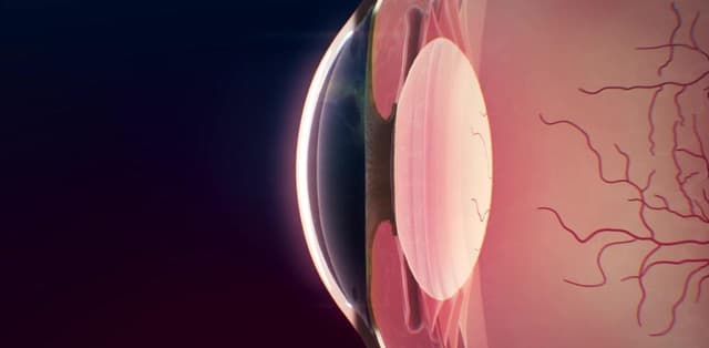 Tìm hiểu các nguyên nhân viêm loét giác mạc