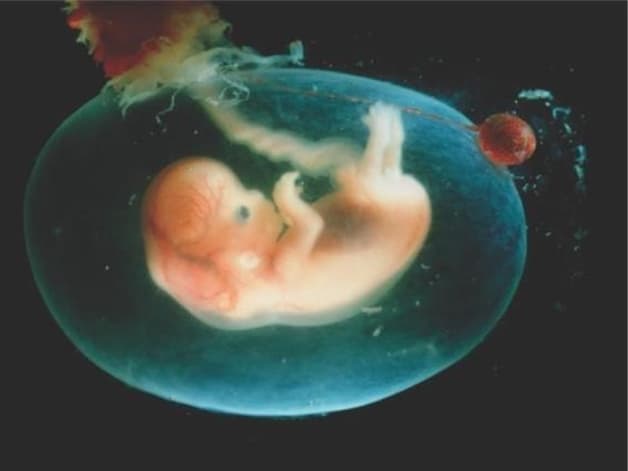 nước ối xanh bẩn