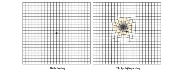 Phù hoàng điểm mắt làm gợn sóng hình ảnh ở thị trường trung tâm