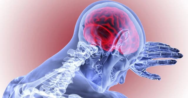 Cách xử trí và điều trị kịp thời bệnh tai biến mạch máu não