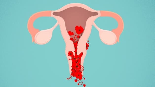 Rong kinh máu cục có thể do các bệnh lý phụ khoa nguy hiểm