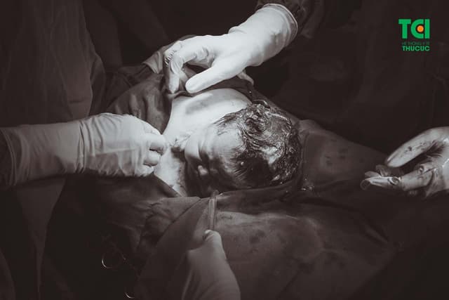 Có thể sinh mổ lần 4 không? Thai phụ cần lưu ý những gì trước đẻ mổ?