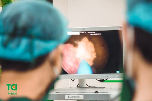 Hướng dẫn cách điều trị sỏi tiết niệu