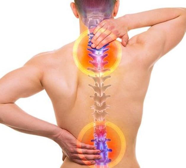 Bệnh thoái hóa cột sống chủ yếu ở vùng cổ và thắt lưng