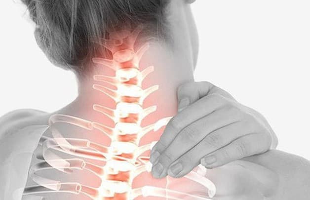 thoái hóa đốt sống cổ dấu hiệu là những cơn đau nhức khó chịu ở vùng cổ vai gáy