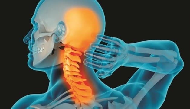 Thoái hóa sống cổ là bệnh lý mãn tính về xương khớp