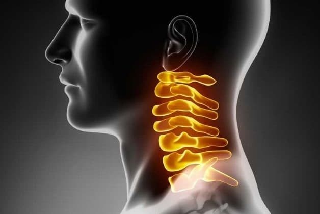 Thoái hóa đốt sống cổ dần trở thành bệnh lý phổ biến trong cuộc sống hiện đại 