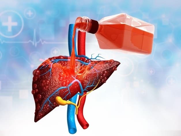 viêm gan rượu là gì