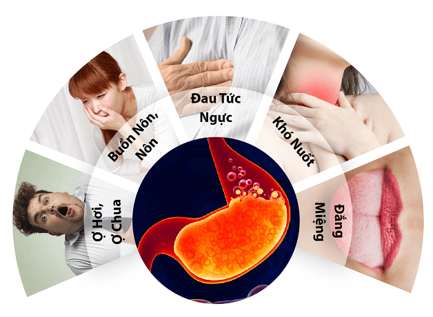 Viêm loét dạ dày có nhiều triệu chứng khác nhau