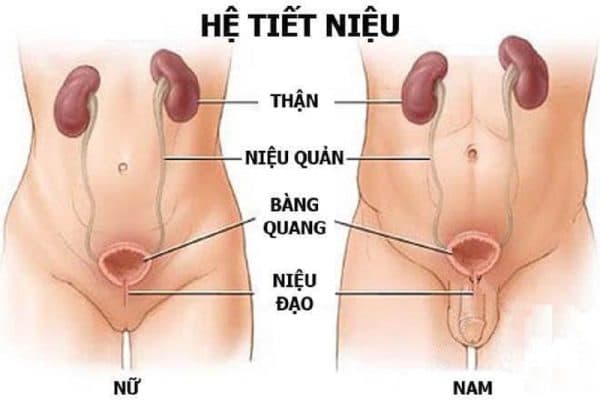 Nguyên nhân sỏi niệu đạo điển hình 