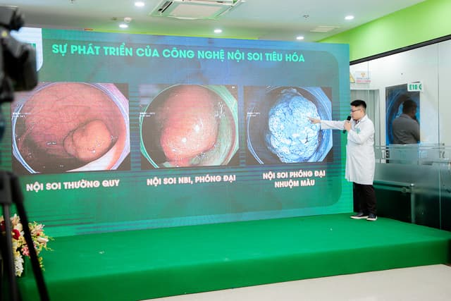 HỘI THẢO: “ĐỘT PHÁ CÔNG NGHỆ NỘI SOI MCU