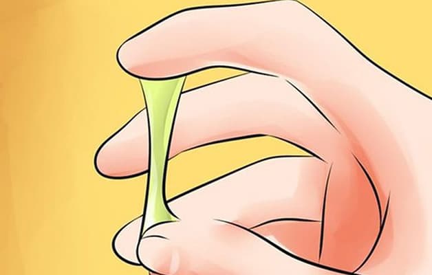 Viêm âm đạo làm thay đổi tính chất của khí hư, khiến cho khí hư có dạng đặc dính, màu vàng, xanh như mủ