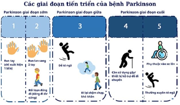 thế nào là bệnh Parkinson giai đoạn cuối?