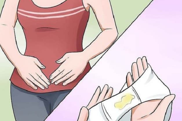 Những bất thường từ màu sắc, mùi khí hư có thể là dấu hiệu cho thấy bị viêm âm đạo