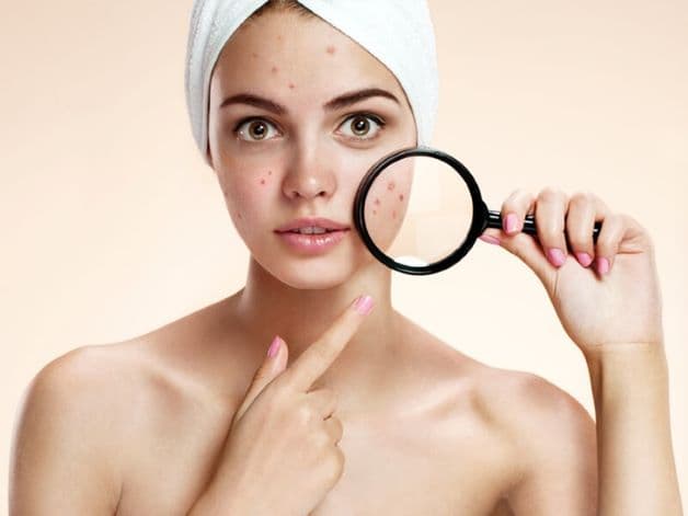 Sự thay đổi về ngoại hình có thể báo hiệu vấn đề liên quan đến rối loạn kinh nguyệt