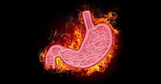 Viêm dạ dày là bệnh lý thường gặp ở hệ tiêu hóa