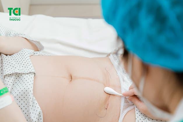 Đẻ mổ bao lâu ăn được xôi? Để giữ cho vết mổ phục hồi, tránh để lai sẹo xấu, các mẹ cần kiêng ăn xôi sau 6 tháng mổ đẻ