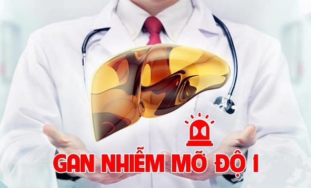 điều trị gan nhiễm mỡ độ 1