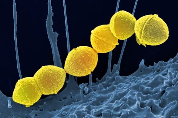 Vi khuẩn Streptococcus pyogenes được xem là tác nhân chính gây ra bệnh viêm họng ở trẻ
